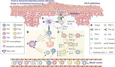 Updates on immunological mechanistic insights and targeting of the oral lichen planus microenvironment